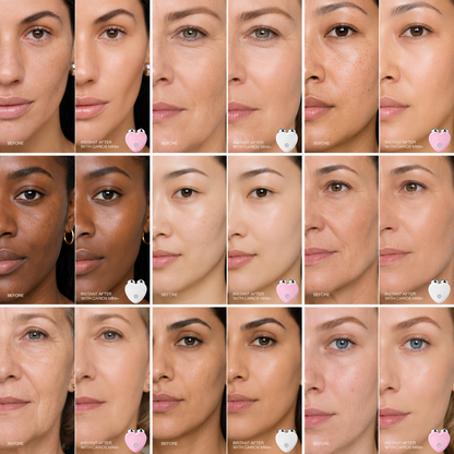 CARIOS Sculpt PRO face lifting device - professional skincare treatment at home